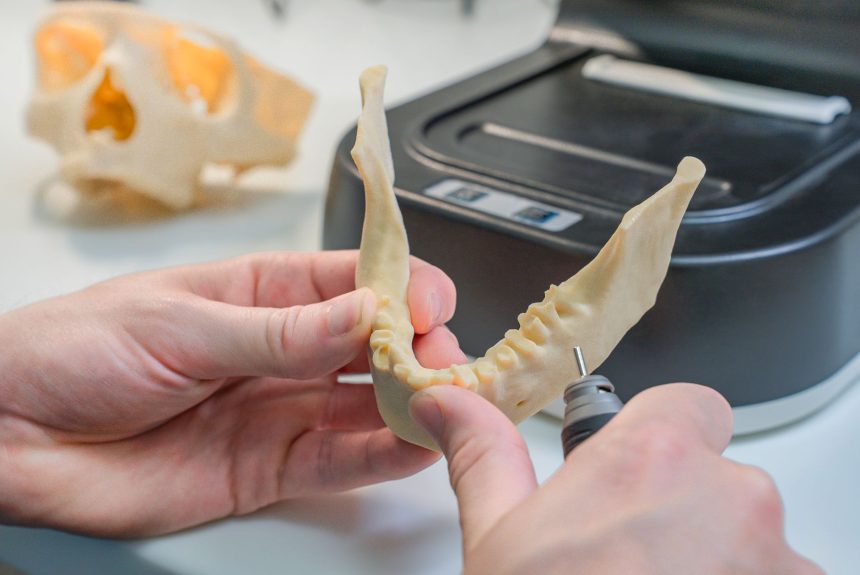 Técnico aprimora um modelo dentário produzido em impressão 3D usando ferramentas e luvas em um laboratório.
